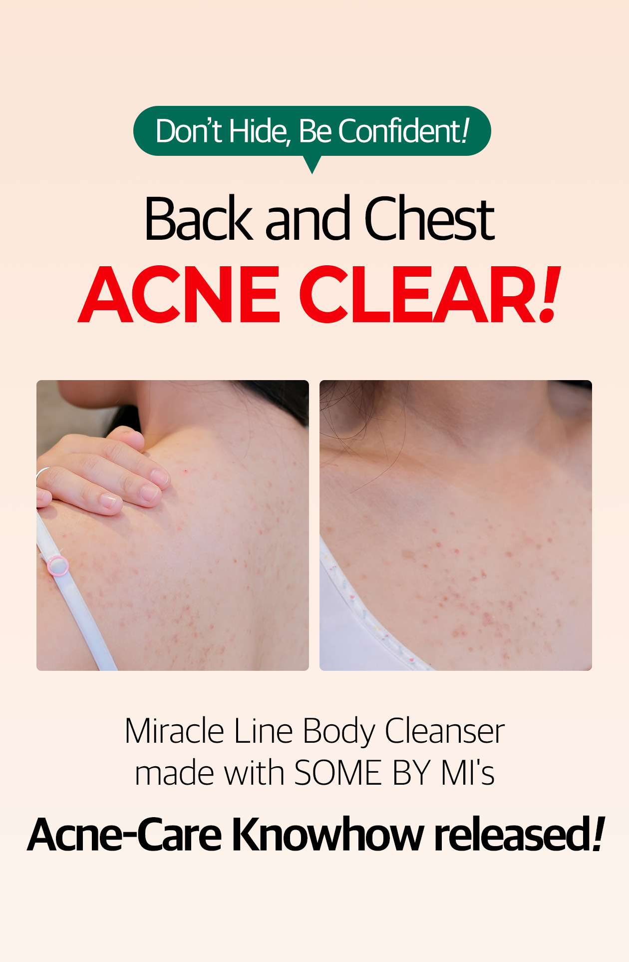 SOME BY MI - AHA-BHA-PHA 30days Miracle Acne Clear Body Cleanser - 400g