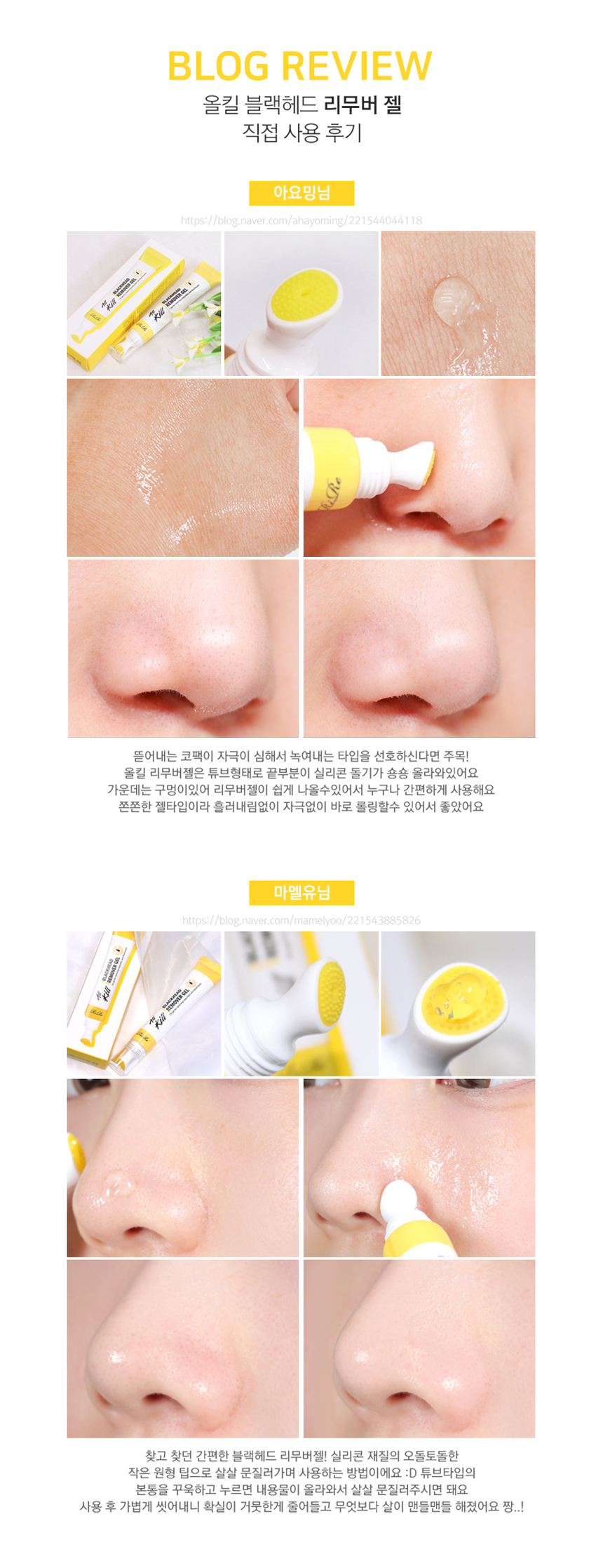 RiRe - All Kill Blackhead Remover Gel