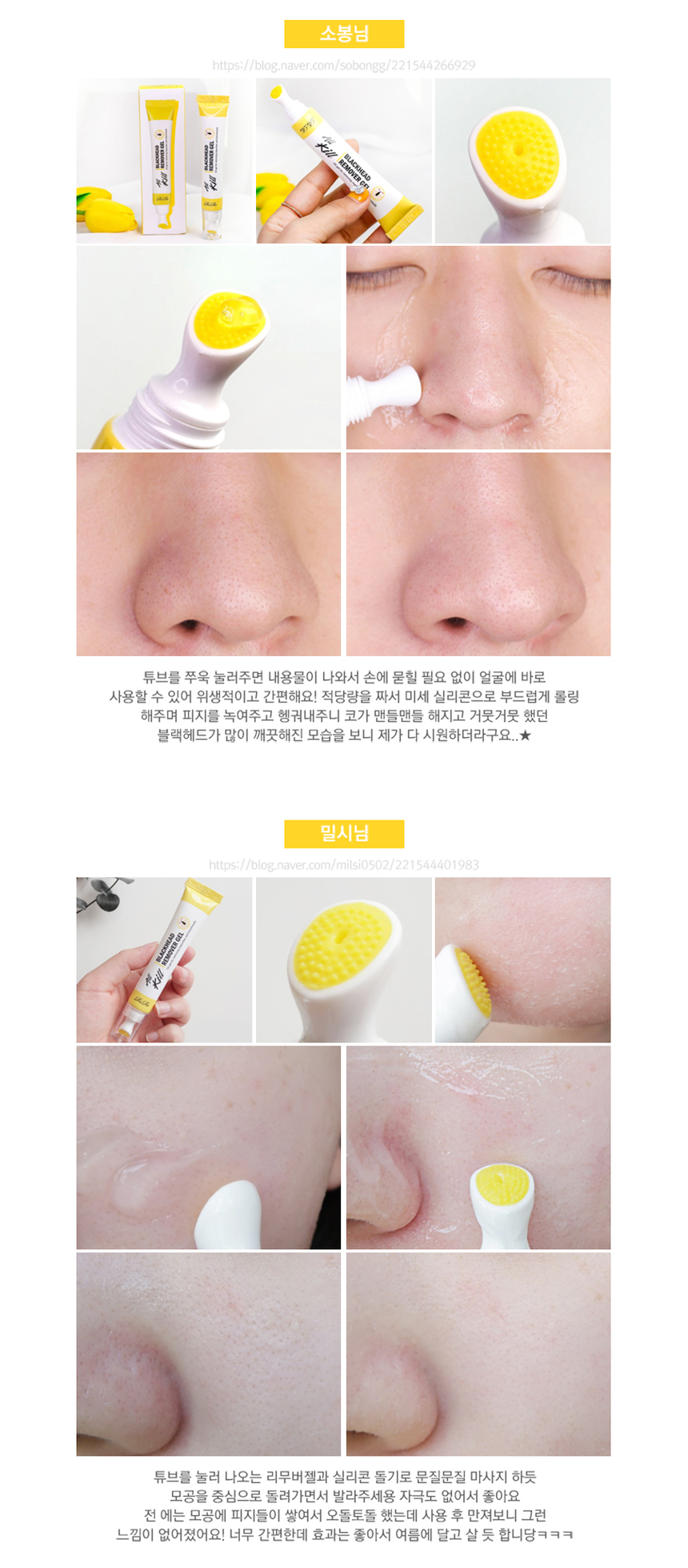 RiRe - All Kill Blackhead Remover Gel