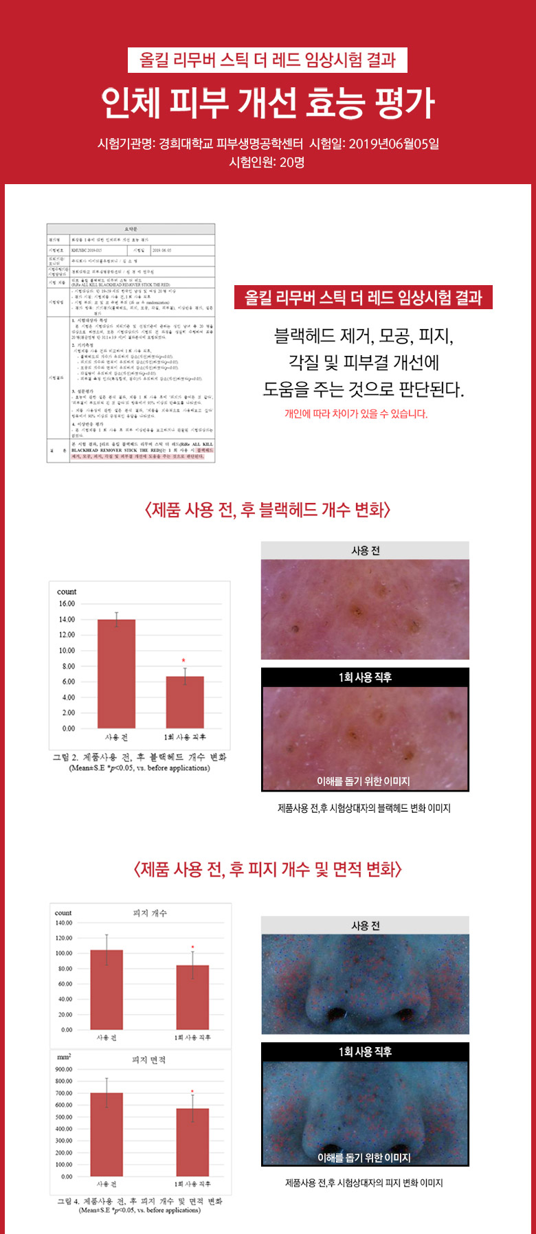 RiRe - All Kill Blackhead Remover Stick - The Red