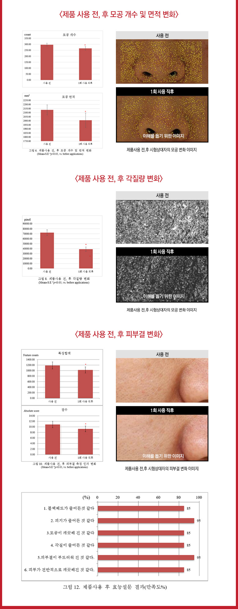 RiRe - All Kill Blackhead Remover Stick - The Red