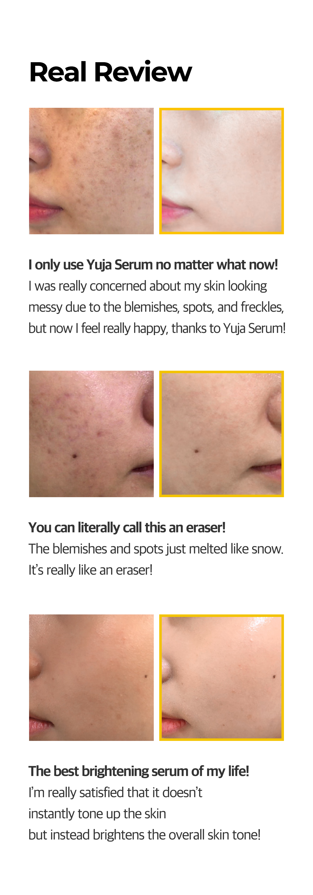 SOME BY MI - Yuja Niacin Blemish Care Serum - 50ml
