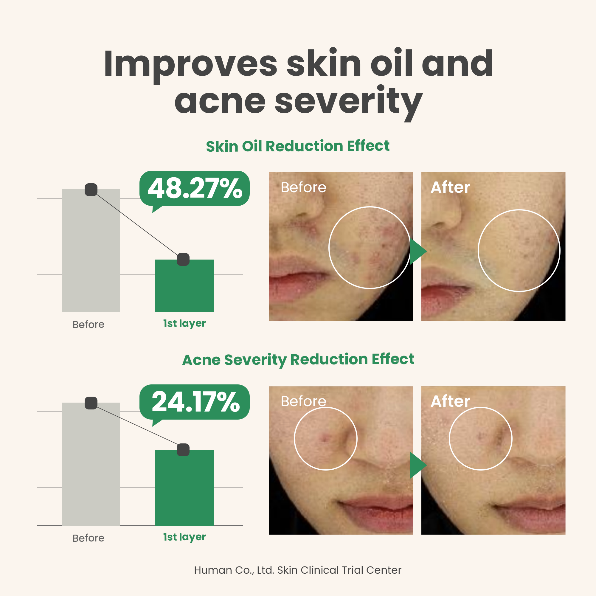 AXIS-Y - Spot The Difference Blemish Treatment - 15ml