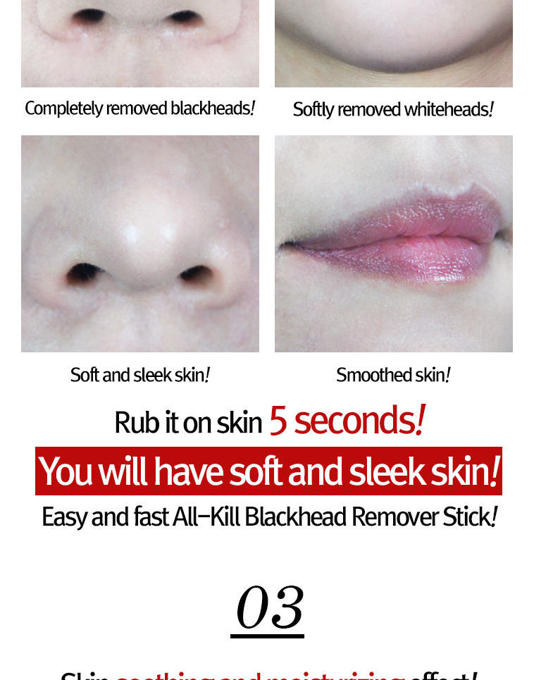 RiRe - All Kill Blackhead Remover Stick