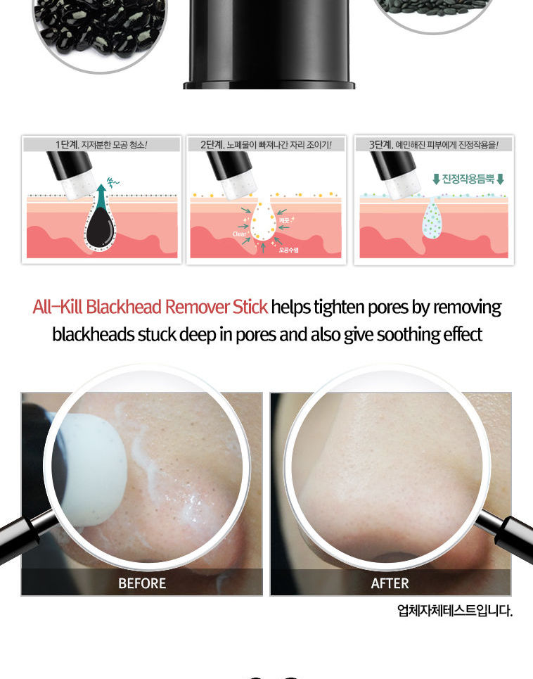 RiRe - All Kill Blackhead Remover Stick
