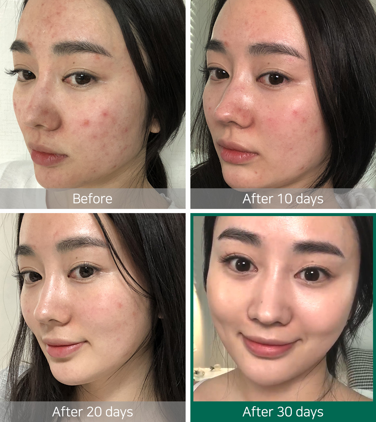 SOME BY MI - AHA-BHA-PHA 30 Days Miracle Toner - 100ml
