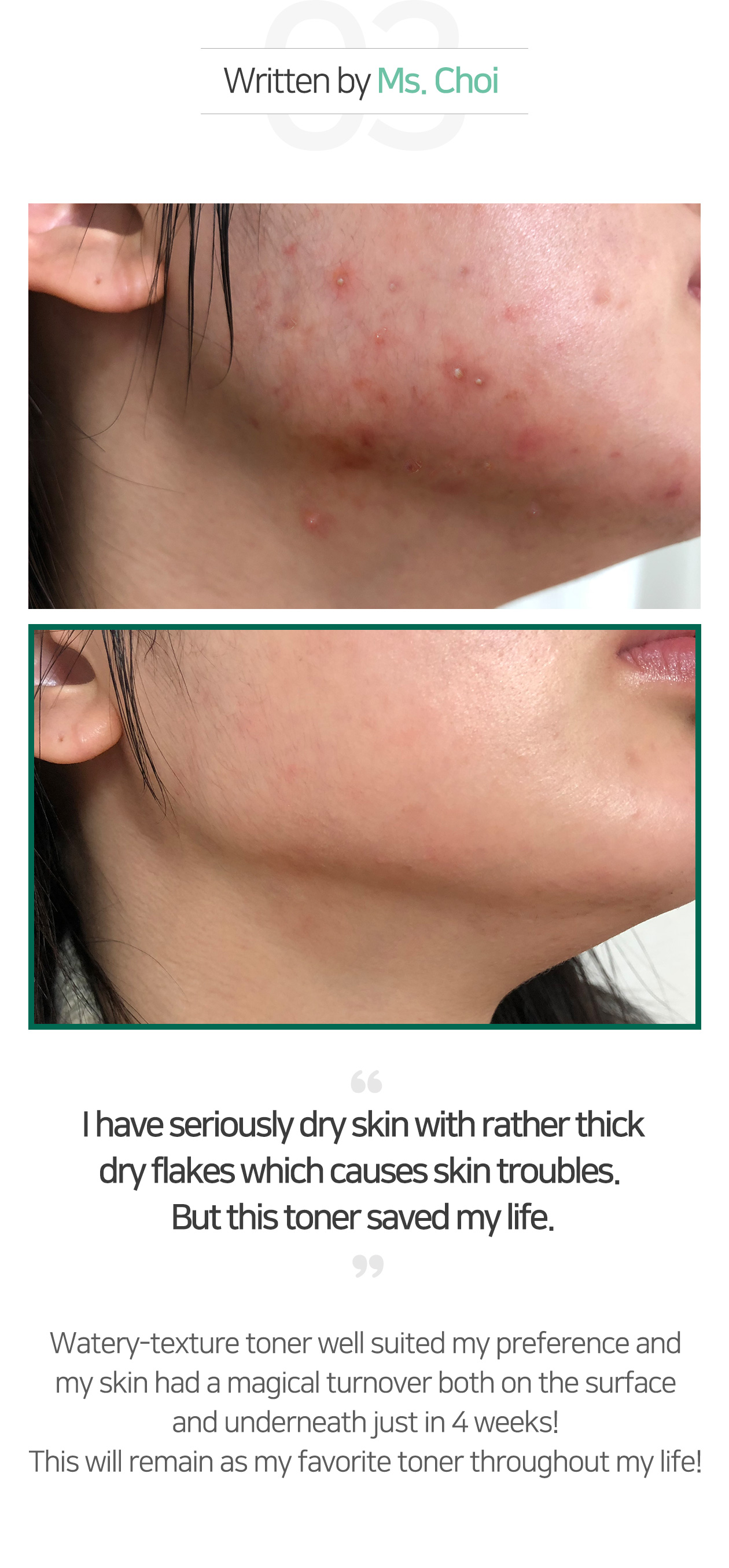 SOME BY MI - AHA-BHA-PHA 30 Days Miracle Toner - 100ml