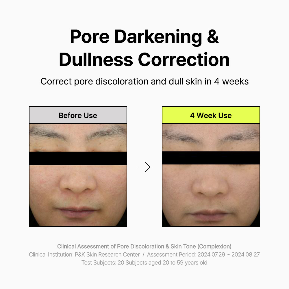 ByWishtrend - Pore Smoothing Bakuchiol Serum - 30ml