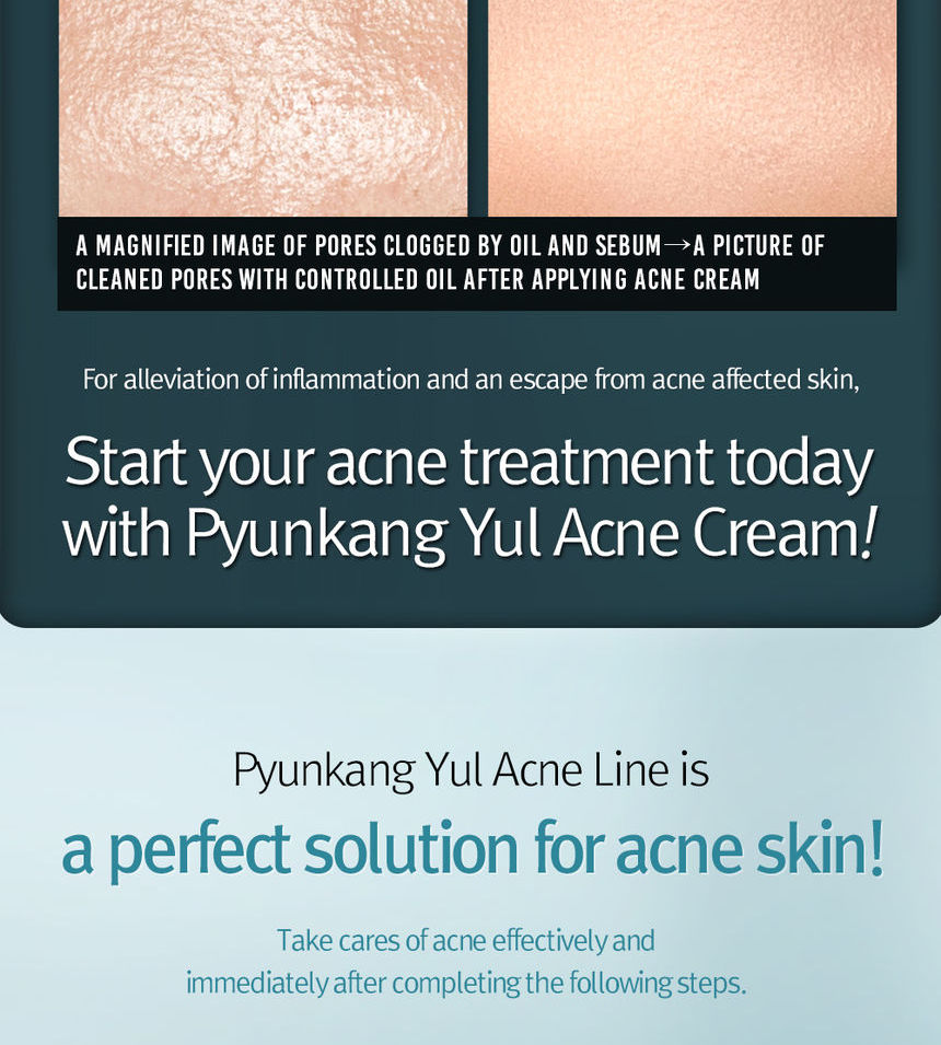 Pyunkang Yul - Acne Cream
